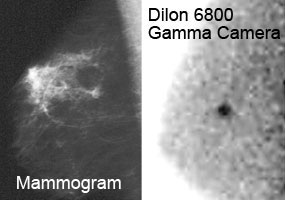 Dilon 6800 Gamma Camera 